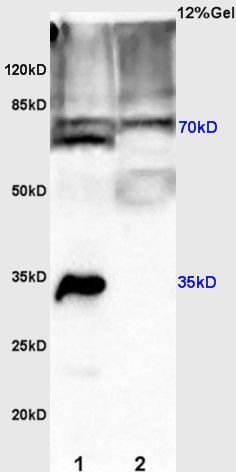 p70 S6 Kinase Beta (phospho-Thr229) antibody